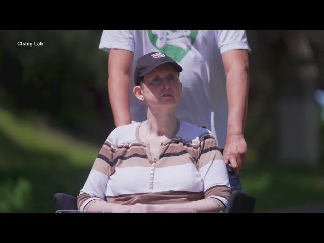 AI technology allows stroke victim to have her voice again